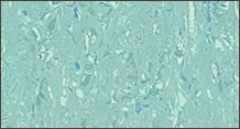 Vinelle Flooring vinyl-sheet-aquamarine